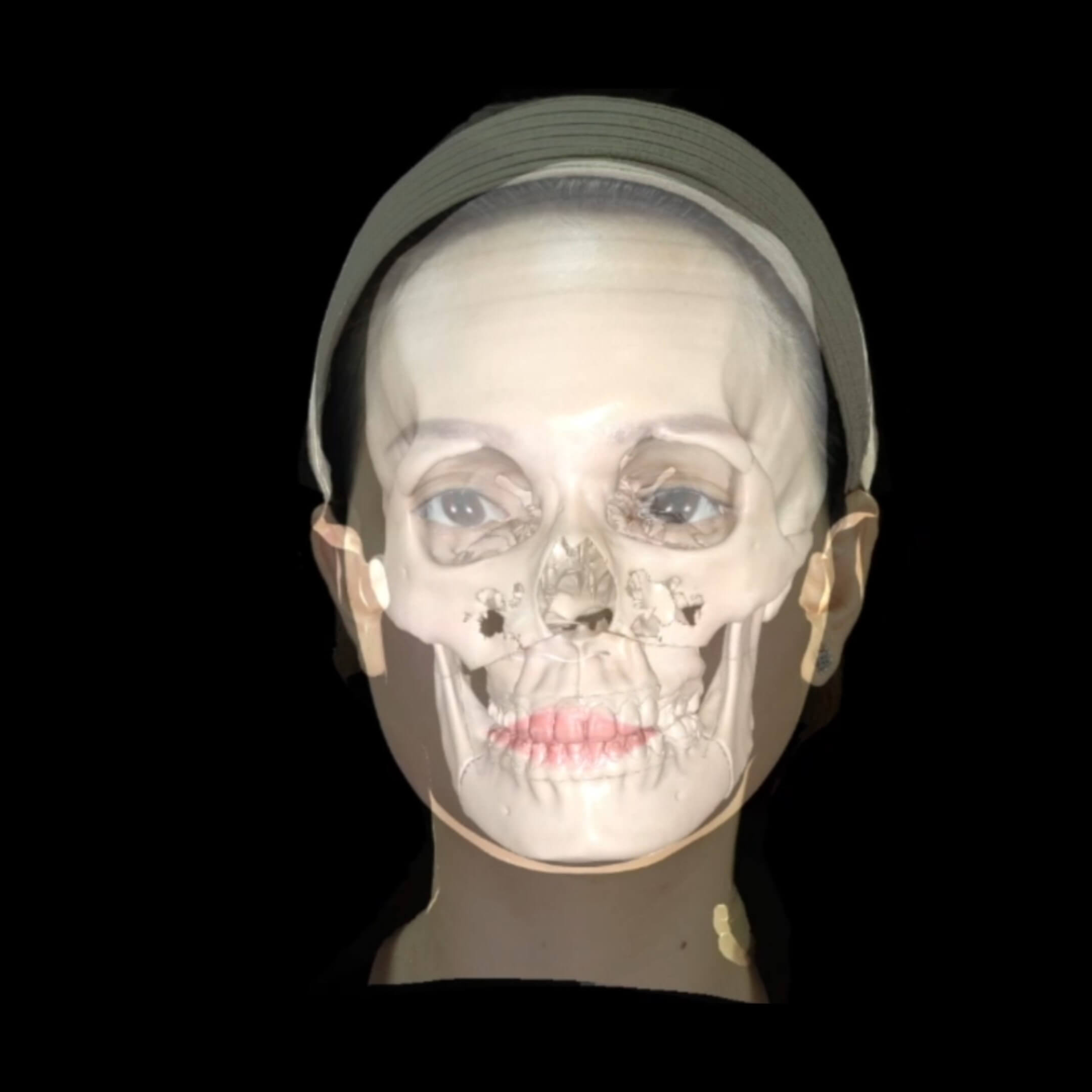 3D数字化整形系统 颌面美学